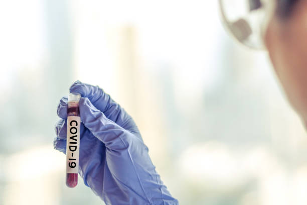 coronavirus covid 19 - coronavirus in morbihan france